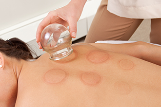 cupping therapy in Bethesda, MD